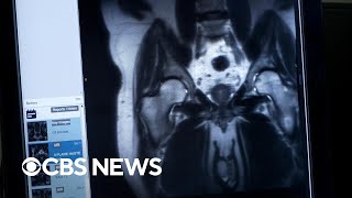 Mt. Sinai medical school embraces AI education platform