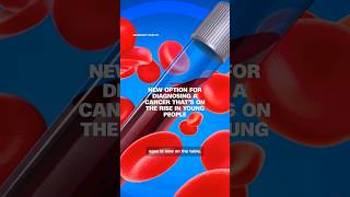New option for diagnosing a cancer that’s on the rise in young people